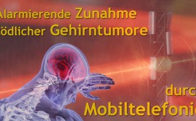 Alarmierende Zunahme tödlicher Gehirntumore (Glioblastome) ...