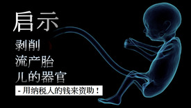 剥削流产胎儿的器官--用纳税人的钱来资助!